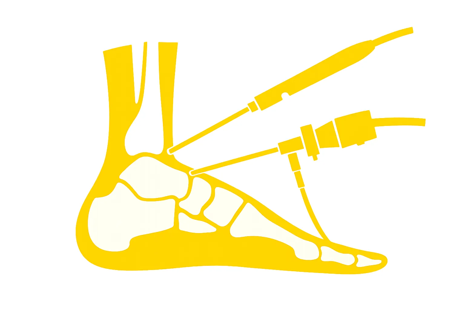 Foot & Ankle Surgery